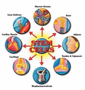 banca celule stem